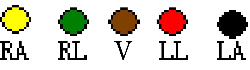 5 leads AHA color coding